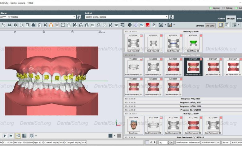 Onyxceph full modules crack download