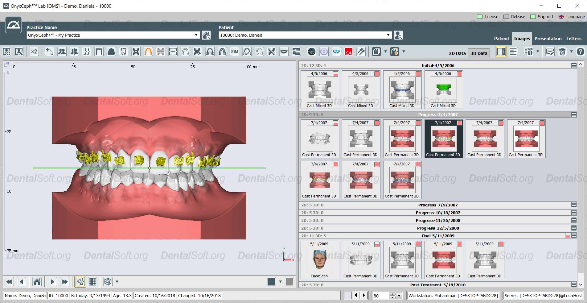 Onyxceph full modules crack download